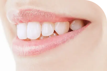審美歯科