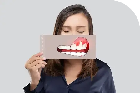 歯周病治療