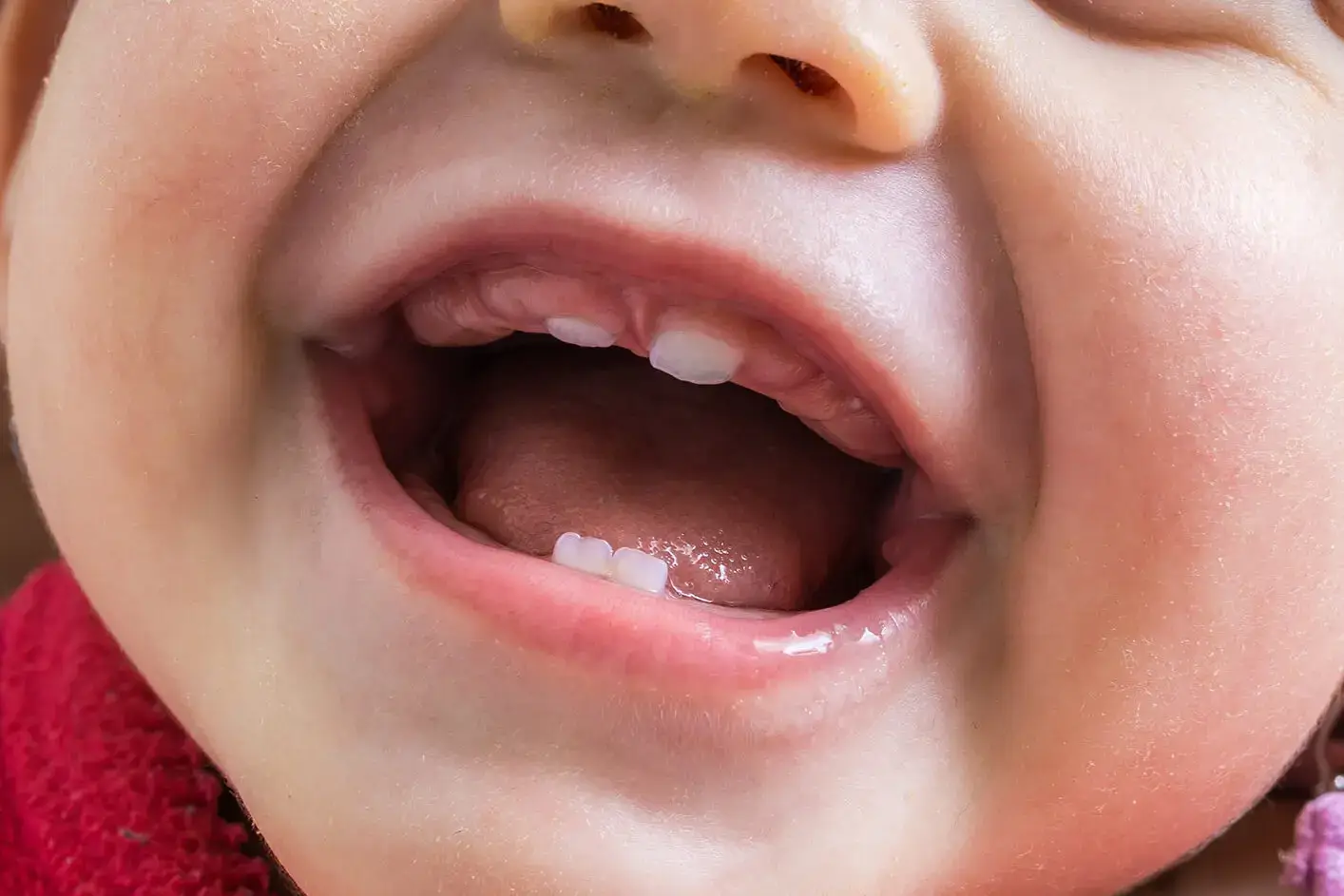 お子さまのための小児歯科治療
