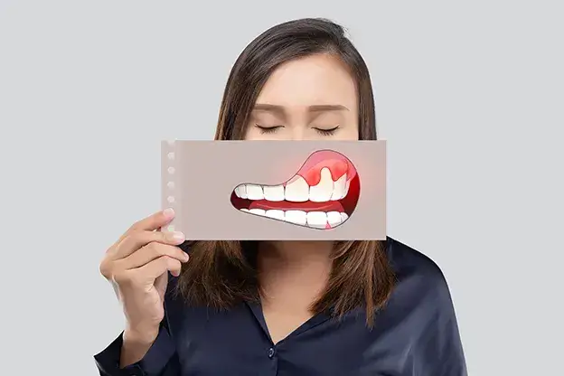 歯周病