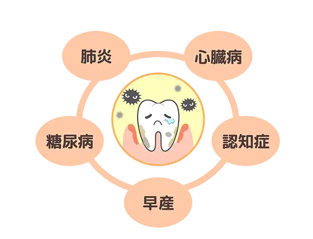 歯周病になるとどのような困ったことが起きるのか